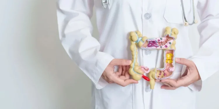 Câncer de intestino cresce entre jovens no mundo, alerta estudo