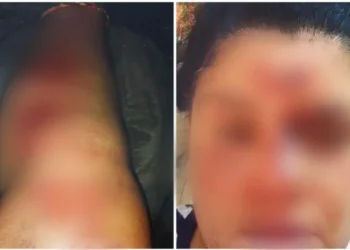 Ferimentos da vítima • Reprodução