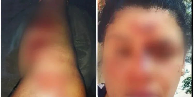 Justiça solta homem que estuprou e arrastou com trator mulher com deficiência auditiva