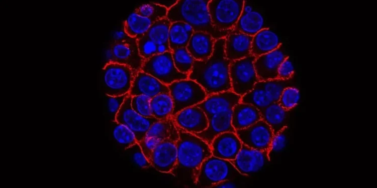Rússia anuncia duas vacinas contra o câncer para distribuição gratuíta em 2025