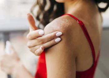 Doenças de pele são frequentes no verão devido a maior exposição solar e a alta umidade do ar • Eleganza/GettyImages