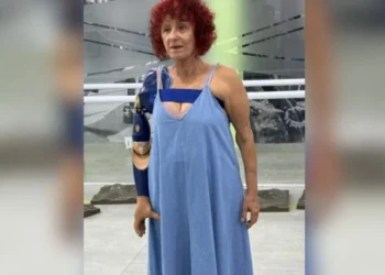 Justiça do Rio de Janeiro determinou que a prefeitura de Saquarema e o governo do estado fornecessem a prótese • Redes Sociais