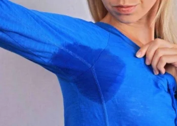 A hiperidrose é caracterizada pelo suor excessivo e anormal das glândulas sudoríparas
crédito: Albina Gavrilovic de Getty Images