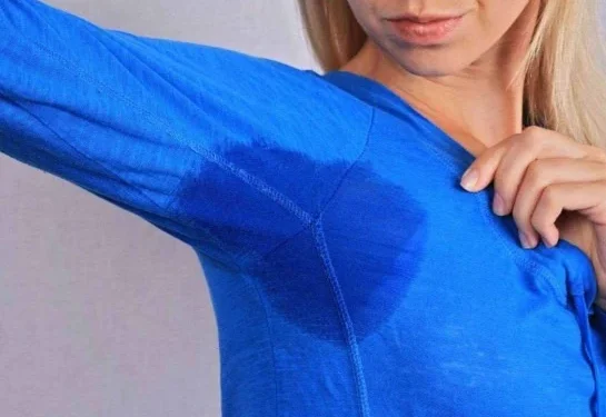 A hiperidrose é caracterizada pelo suor excessivo e anormal das glândulas sudoríparas
crédito: Albina Gavrilovic de Getty Images