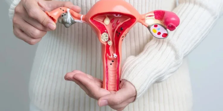 O que é infecção tubo-ovariana? Saiba mais sobre a complicação