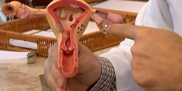 Um dos sintomas da endometriose é a cólica intensa durante a menstruação, que pode ser constante e progressiva crédito: Frame/TV Brasil