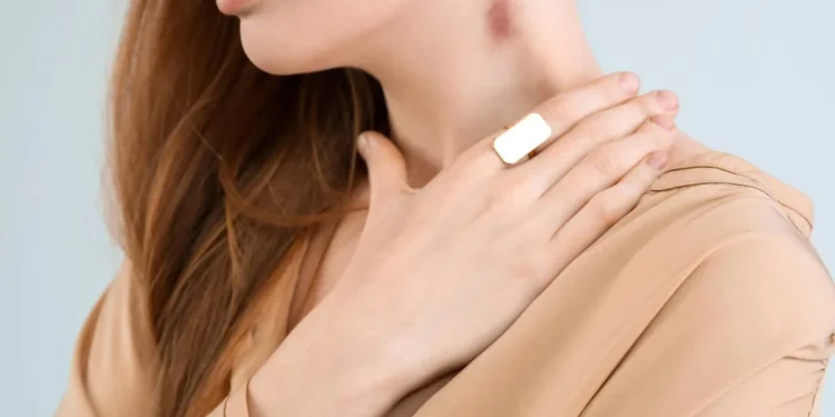 Chupão no pescoço leva mulher de 35 anos a ter AVC; entenda