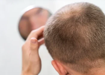 A genética é uma das causas mais comuns, mas existem formas de controlar e evitar o avanço