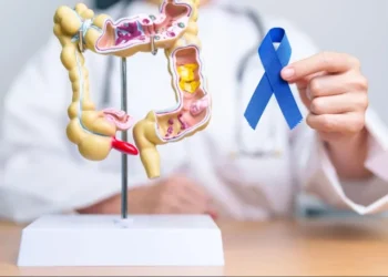 Câncer colorretal: saiba riscos, prevenção e tratamento