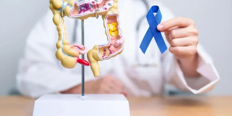 Câncer colorretal: saiba riscos, prevenção e tratamento