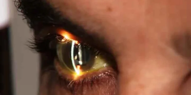 Um terço dos brasileiros com doenças oculares graves abandona o tratamento