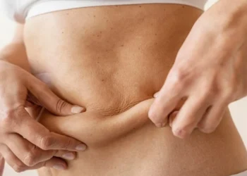 Os melhores candidatos para lifting corporal são aqueles que atingiram um peso estável, têm boa saúde e expectativas realistas sobre os resultados da cirurgia crédito: Freepik