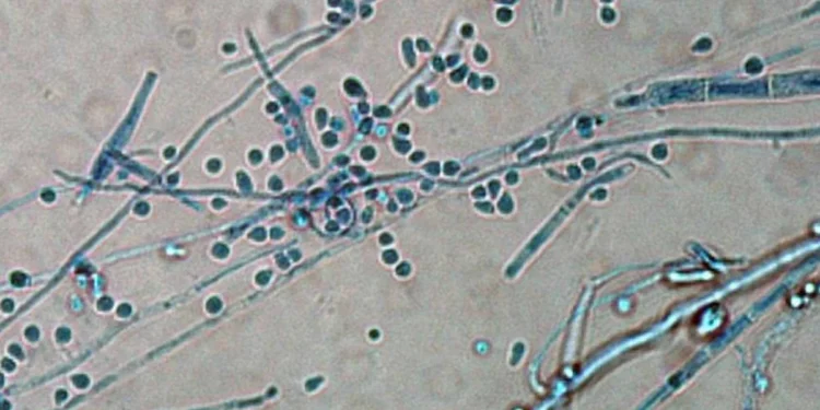 Primeiro caso de infecção por fungo resistente no Brasil: entenda