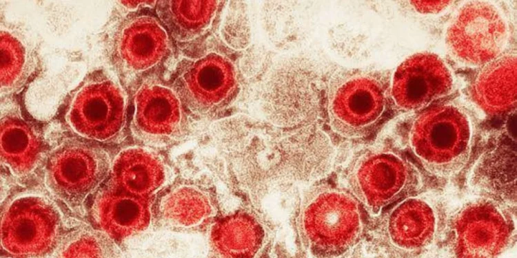 O herpes zoster acontece pela reativação do vírus varicela, que inicialmente causa a catapora
crédito: Getty Images