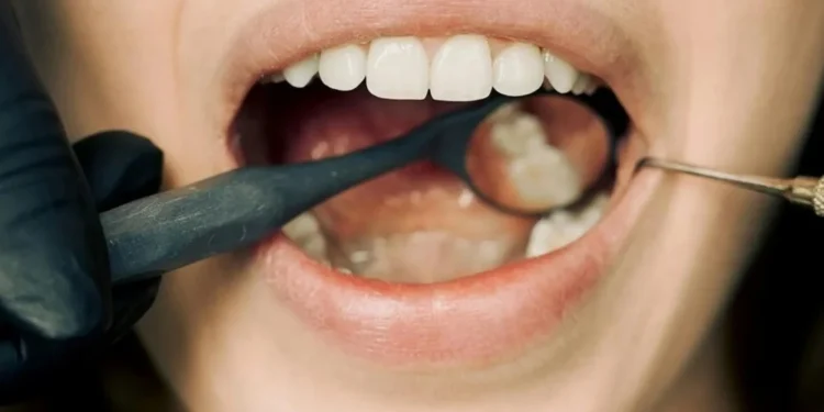 Cuidar da saúde bucal previne doenças neurodegenerativas: entenda relação