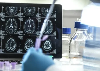 Kisunla é um medicamento injetável, administrado uma vez por mês, e é o primeiro e único tratamento aprovado no Brasil direcionado à placa amiloide • Getty Images/Science Photo Libra