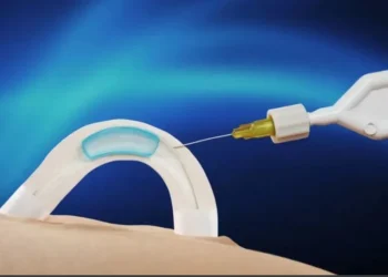 Adam é um hidrogel solúvel em água que é implantado nos canais que transportam o esperma • Contraline/Divulgação