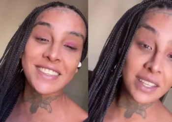 A cantora foi internada em meados de março para cuidar de sua saúde mental após um agravamento do quadro de depressão • Instagram/Linn da Quebrada