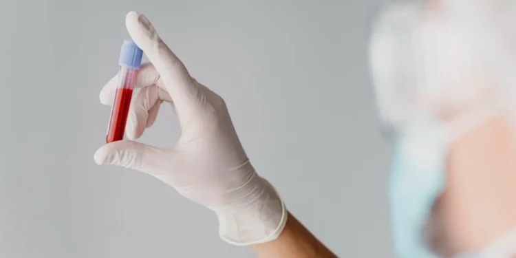 Tuberculose: quem tem doença inflamatória imunomediada deve fazer teste?