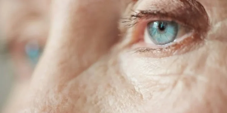 O glaucoma é uma doença que surge devido ao aumento da pressão intraocular e atinge pessoas principalmente a partir dos 40 anos - crédito: Freepik