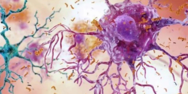 Inflamação no cérebro por dieta rica em gordura atrai células imunes