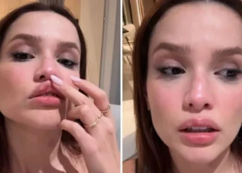 Juliette fratura nariz após acidente doméstico • Instagram/Juliette