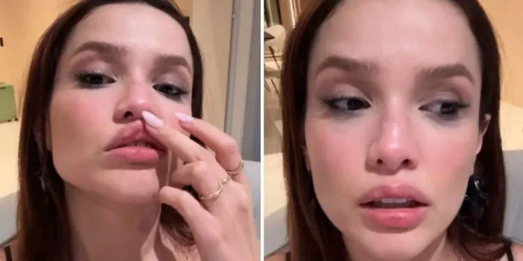 Juliette sofre fratura no nariz após acidente doméstico: “Meio torto”