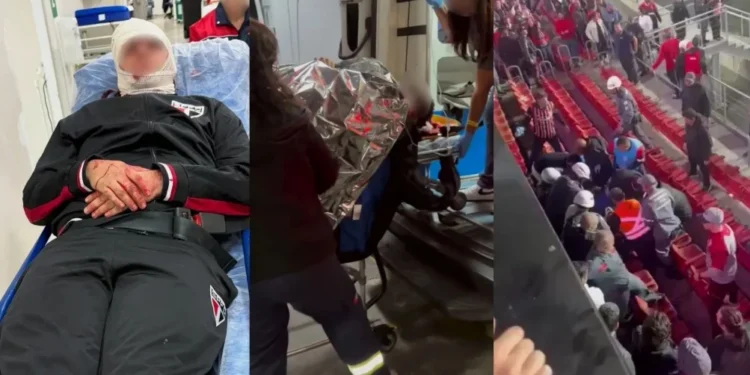 Placa de ferro cede e fere torcedores no Morumbis durante jogo do São Paulo
