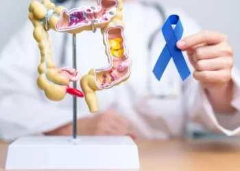 Câncer colorretal é um dos mais prevalentes e deve ser rastreaado precocemente  • Getty Images