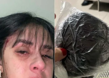 A cantora sertaneja de Blumenau, em Santa Catarina Débora Amorim, por meio das redes sociais, contou ter sido vítima de um ataque violento na noite da última quinta-feira (29/5) - crédito: Reprodução/Instagram/@deboraamorimofc