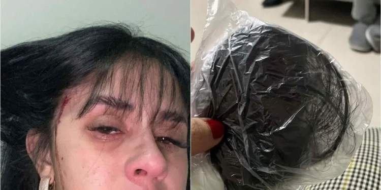 Cantora sertaneja é agredida e tem cabelo cortado logo após sofrer ameaças