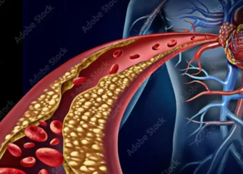 O medicamento VERVE-102 promete reduzir formações de placas de colesterol em artérias  • Adobe Stock