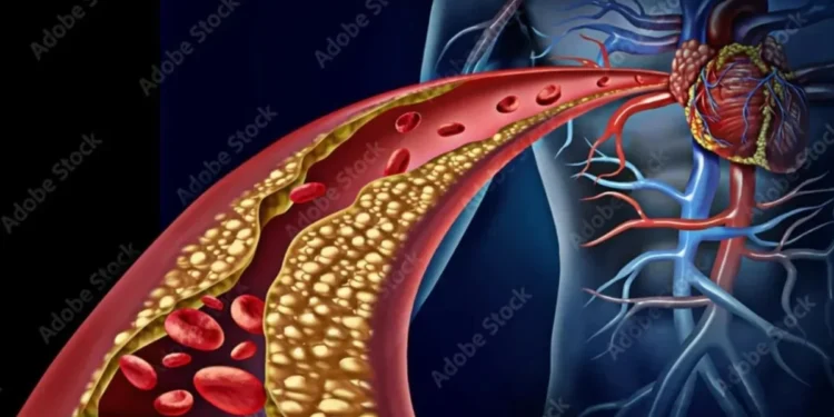 Dose única de medicamento reduz colesterol em até 69%, diz estudo inicial