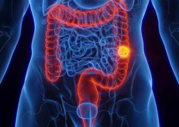 Mortalidade por câncer colorretal deve aumentar bastante no Brasil nos próximos anos, mostram projeções crédito: Getty Images