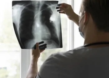 IA da Universidade Federal Fluminense ajuda a detectar enfisema pulmonar e câncer de pulmão • Freepik