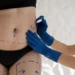 Brasil é o país que mais realiza cirurgia plástica no mundo, diz relatório