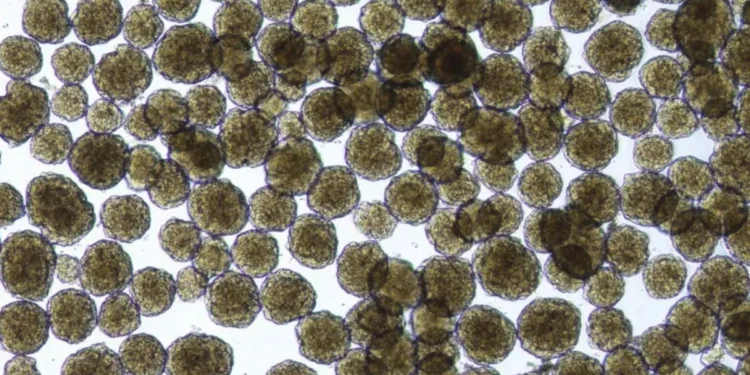 As ilhotas criadas em laboratório a partir de células-tronco agem como as naturais • Vertex Pharmaceuticals/Divulgação