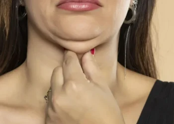 Saiba como se forma a papada na região do queixo • Getty Images