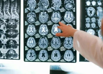 Pesquisa indica que pandemia de Covid-19 pode ter acelerado envelhecimento cerebral • Anna Shvets/Pexels