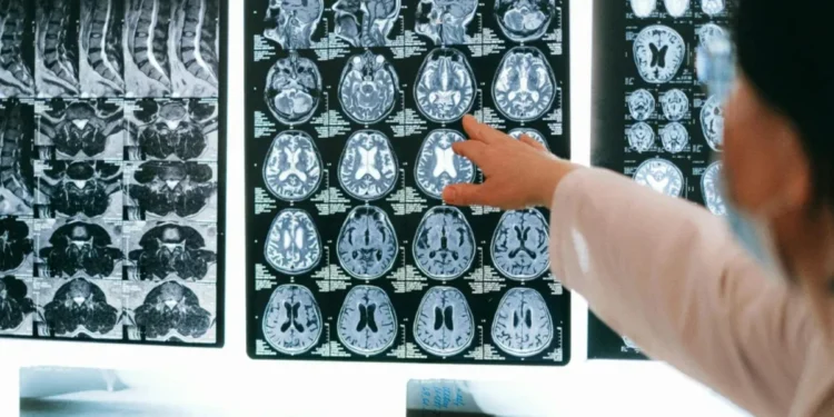 Estresse na pandemia pode ter envelhecido nossos cérebros, diz estudo