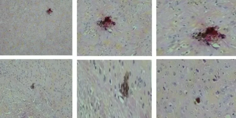 Vacina contra vírus zika mostra resultados promissores em testes