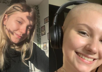 Isabel Veloso resgatou fotos antigas de seu tratamento para falar sobre queda de cabelo e outras dúvidas dos seguidores • Instagram/Isabel Veloso