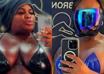 Após a cirurgia bariátrica e o emagrecimento, Jojo Todynho investiu em procedimentos estéticos para retirar a pele em excesso • Instagram/Jojo Todynho