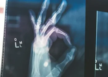 Saúde dos ossos é fundamental para diversos sistemas do corpo • Foto de Owen Beard na Unsplash