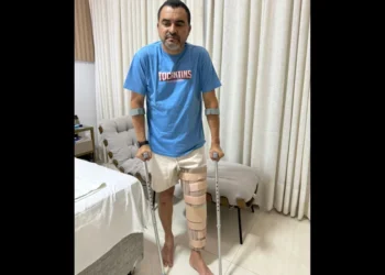 Governador Wanderlei Barbosa rompe ligamentos do joelho e passará por cirurgia.
