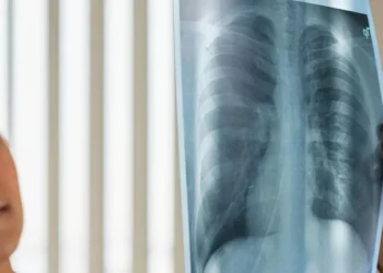 Câncer de pulmão é o segundo tipo mais comum no mundo  • Cottonbro Studio/Pexels