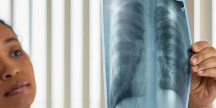 Câncer de pulmão é o segundo tipo mais comum no mundo • Cottonbro Studio/Pexels