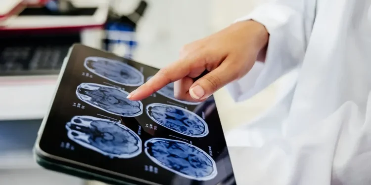 Cirurgia cerebral pode tratar depressão resistente; entenda como funciona