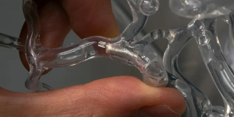 Microrrobôs que removem coágulos prometem revolucionar o tratamento do AVC
