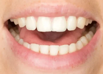 Causa da gagueira é multifatorial, o que significa que ela é resultado de uma combinação fatores como genéticos e neurológicos • 4FR/Getty Images